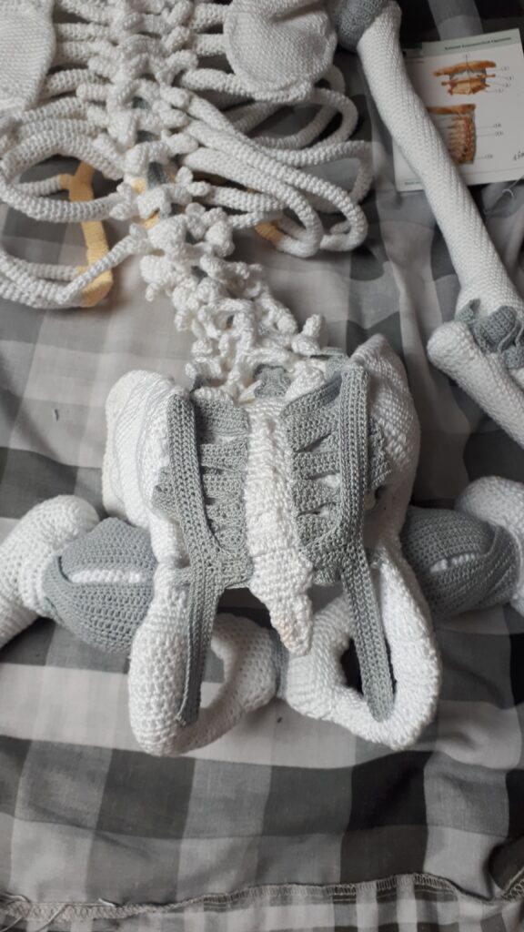 Heup in elkaar zetten 101