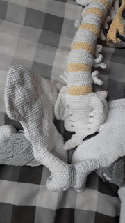 Heup in elkaar zetten 35