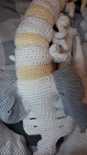 Heup in elkaar zetten 50