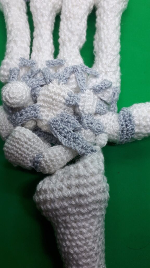 Armen haken 35 Armen haken 34