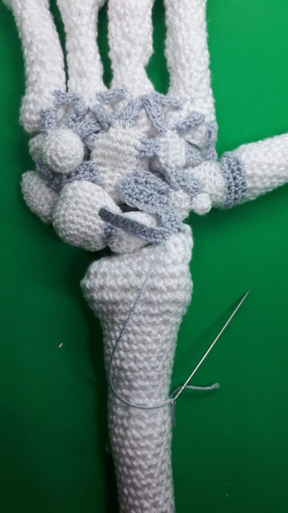 Armen haken 36 Armen haken 35