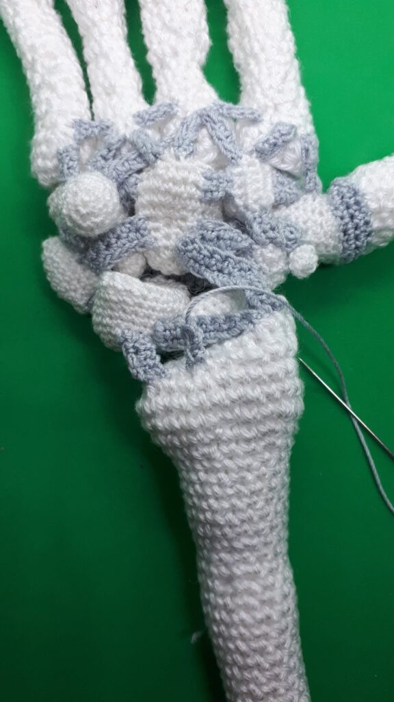 Armen haken 40 Armen haken 39