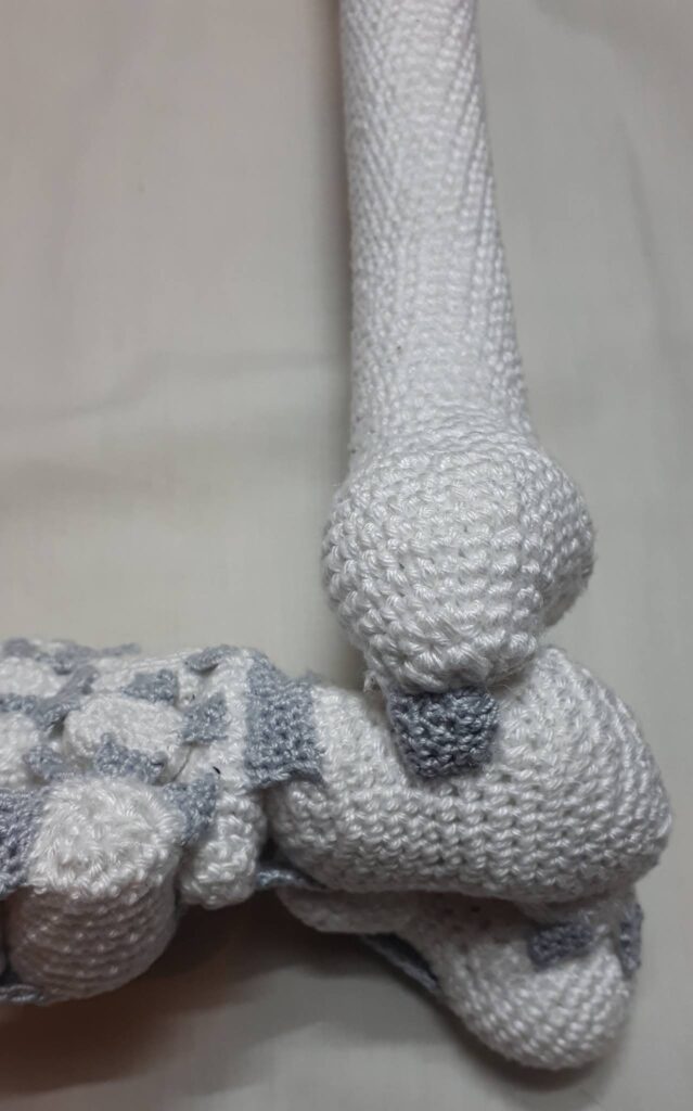 Benen haken 35 Benen haken 34 2