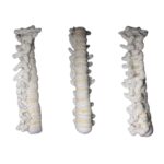 Ruggengraat middelste deel 238 Gratis haakpatroon Ruggengraat middelste deel - Decoratie, Menselijk lichaam - Anchor Creativa Fino, Rico Essentials #10 k...
