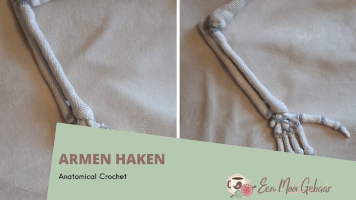 Armen haken