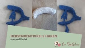 hersenventrikels haakpatroon