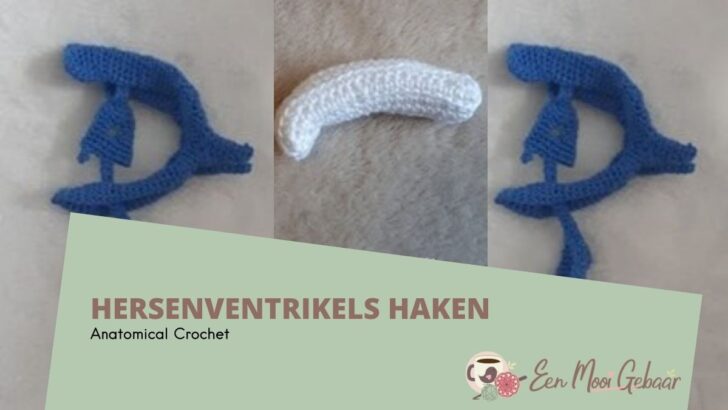 hersenventrikels haakpatroon